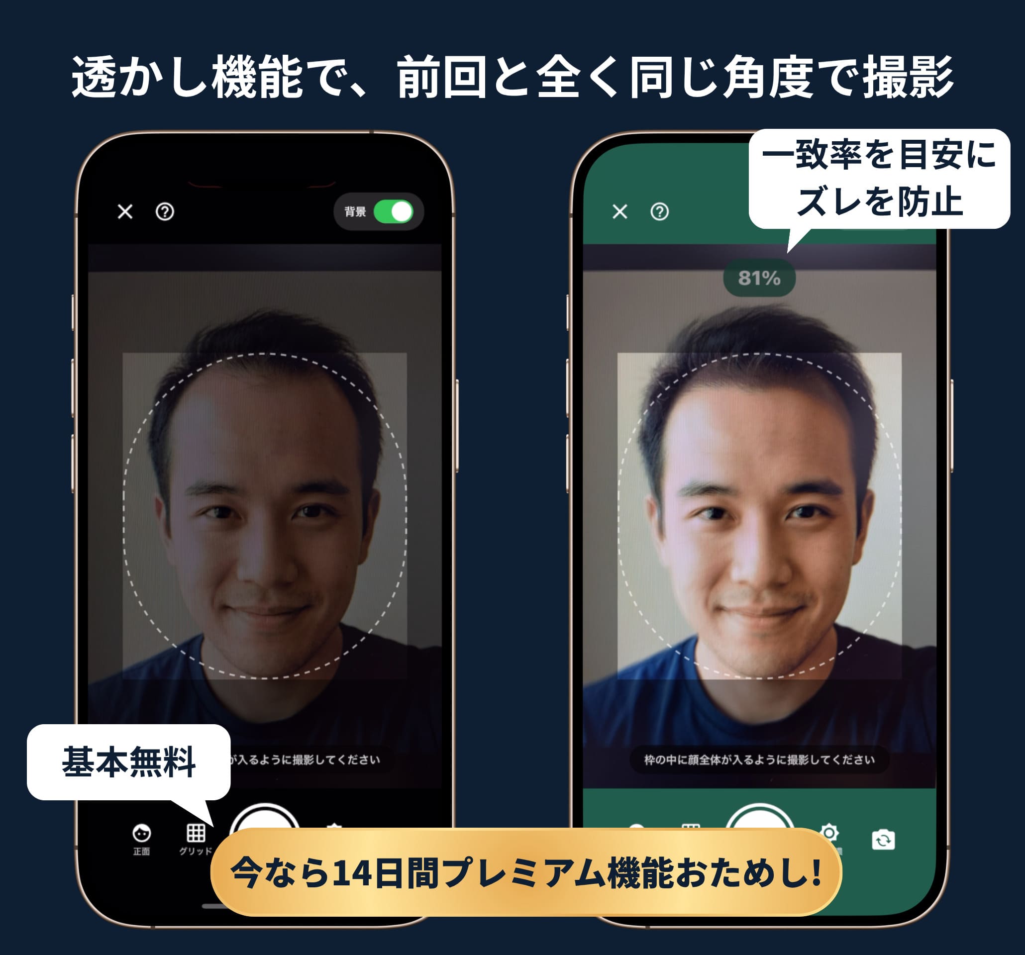 ヘアカム アプリ画面 - 透かし機能で前回と同じ角度で撮影、一致率を目安にズレを防止
